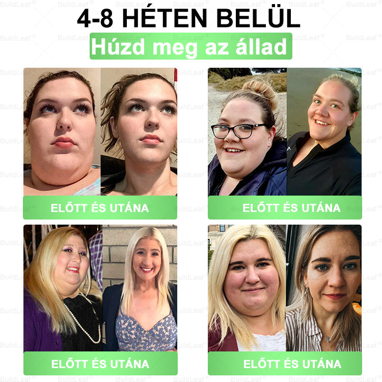 🌿𝑩𝒖𝒊𝒍𝒅𝑳𝒆𝒂𝒇® GLP-1 8 az 1-ben Fit & Vital Szájon át szedhető oldat – Napi egyszer, 7 nap alatt látható változás / Elhízás, szív- és érrendszeri egészség, cukorbetegség, alvási apnoe, bélrendszer egészsége, ízületi problémák és még sok más esetén